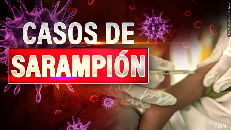 Aumentan los casos de sarampión en el país: ¿Cómo protegerse?