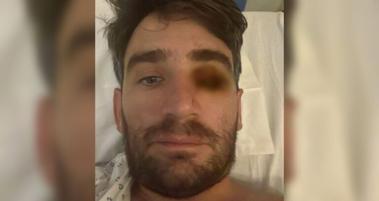 Explosión Pirotécnica en Fiesta de Año Nuevo en San Diego: Hombre Pierde el Ojo