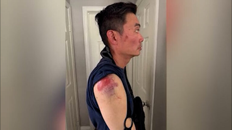 Agente federal acusa a la policía de San Diego de presunto encubrimiento en caso de agresión